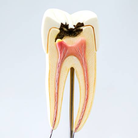 Analyzing the CostEffectiveness of Tooth Models in Prosthetics