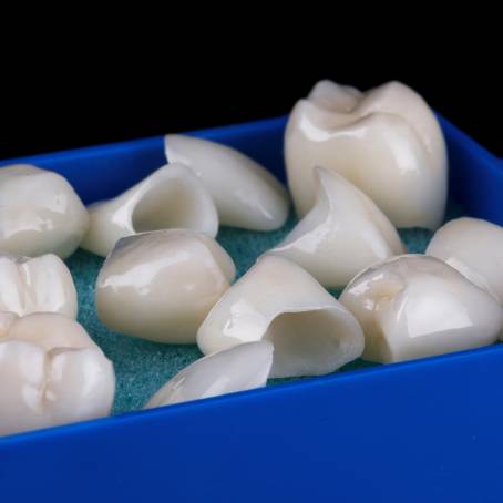 Dental Innovations The Cost of Prosthetic Tooth Models