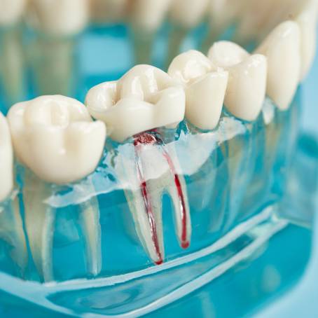 Innovations in Tooth Models Pricing and Practicality